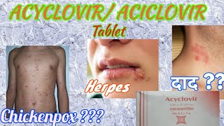 Acyclovir tablets  Herpikind  Herpikind Tablet  Zovirax  Zovirax tablets  uses side effects [upl. by Azarcon123]