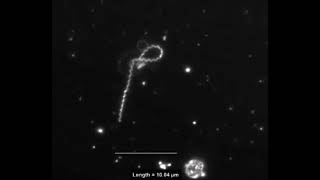 Interaction of Treponema pallidum the syphilis spirochete with human platelets [upl. by Lemon223]