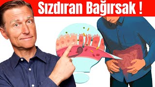 Sızdıran Bağırsakların 7 İşareti  Dr Berg Türkçe [upl. by Ubana]