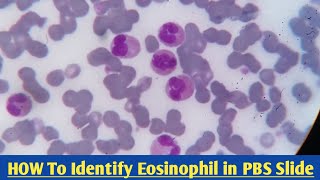 How To Identify Eosinophil Eosinophil Under microscope  Eosinophil in PBS Sllide [upl. by Juliette]