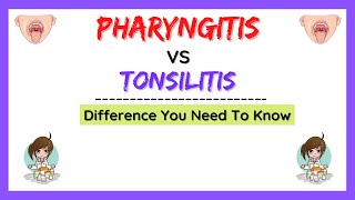 Pharyngitis and tonsillitis difference causes symptoms treatment physiology made easy [upl. by Zimmerman]