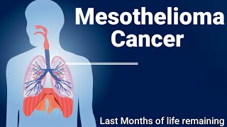 An Introduction to Mesothelioma What is mesothelioma How to treat mesothelioma Mesothelioma [upl. by Arlene298]