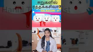 ஈறுகளில் ரத்தக்கசிவா Gum Bleeding  Dr Harini gumbleeding gingivitis oralhygiene facts [upl. by Ellerahs478]