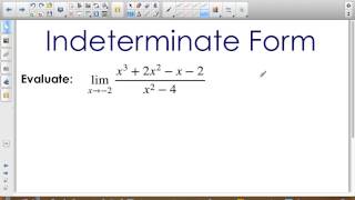 How to Fill Out IRS Form 1099DIV A StepbyStep Guide [upl. by Pyszka922]