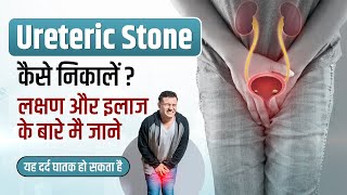 Ureteric Stone in Hindi  Symptoms ManagementTreatment Pain xrays  Ureteric Stone kaise nikale [upl. by Friedland]