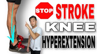 How to Fix Knee Hyperextension after a Stroke [upl. by Trab245]