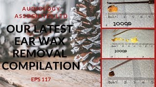 OUR LATEST EAR WAX REMOVAL COMPILATION VIDEO  EP 117 [upl. by Anay]