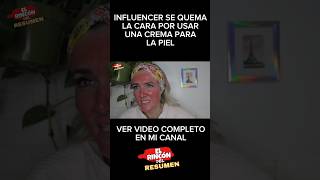 INFLUENCER SE QUEMA LA CARA CON UNA CREMA PARA LA PIEL [upl. by Yelyah]