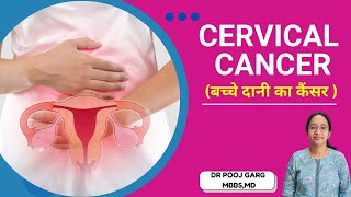 Cervical Cancer  बच्चेदानी का कैंसर  Dr Pooja Garg  Cancer  Uterus Cancer  HPV VACCINE [upl. by Iphigenia]