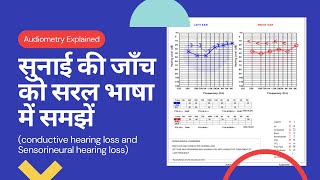 Hearing test explained  सुनाई की जाँच ।Deafness test in Hindi  Pure tone Audiometry interpretation [upl. by Negris]