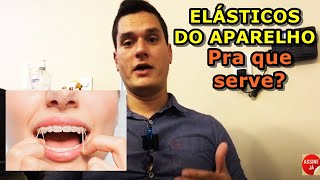 Elástico do aparelho para que serve [upl. by Rifkin]