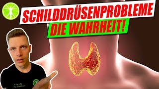 Schilddrüsenprobleme die Wahrheit❗ WARUM DU Schilddrüsenprobleme hast❗ KLARTEXT❗ [upl. by Gazzo]