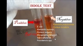 Indole test positive Indole test enterobacteria practical microbiology [upl. by Airetak]