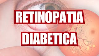 RETINOPATIA DIABETICA SIGNOS Y SINTOMAS  ¿CUAL ES EL TRATAMIENTO [upl. by Esinet]