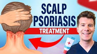 Doctor explains FOUR TREATMENTS for SCALP PSORIASIS [upl. by Allx608]