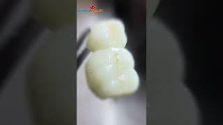 Zirconia crown trending viralshorts hamidraza01 ideal2 dental lab Pune [upl. by Yrtnahc]