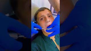 Extraction dentist dentalbeauty satisfying dentalclinic smiledental dentaltreatment smiledesi [upl. by Myrt]