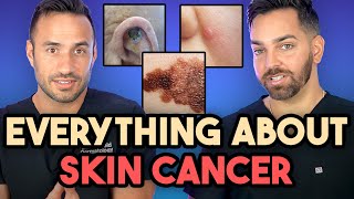 Everything About Skin Cancer Prevent Identify Biopsy and Treatment  Dermatologist Explains [upl. by Theis410]