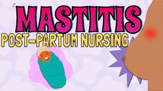 MASTITIS Maternal Newborn Nursing [upl. by Eizzik823]