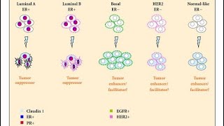 Luminal A B Her2neu enriched Basal categories of Breast Cancer [upl. by Linet210]