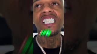 Teeth Grillz [upl. by Seldon]