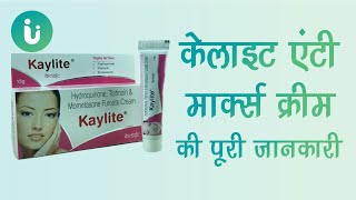 Kaylite Anti Marks Cream ke fayde labh upyog nuksan lagane ka sahi tarika uses review price [upl. by Sidwell]