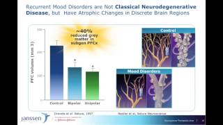 Bipolar Disorder Harnessing Brain Plasticity for Improved Overall Outcomes [upl. by Held]