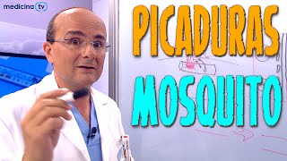 PICADURA DE MOSQUITO ¿Cómo es ¿Qué síntomas producen ¿Cómo hay que actuar ¿Cómo Prevenirlas [upl. by Madaras]