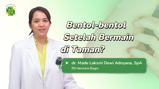 Urtikaria  Gimana si cara cegah bentolbentol pada anak   Part 2 [upl. by Rickie46]