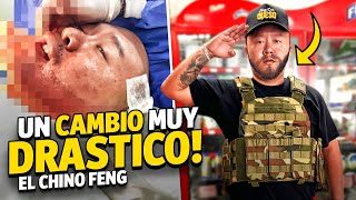 GRAN CAMBIO DE EL CHINO FENG 🇨🇳  se injerta barba y asi luse  chino barbon 🔥 [upl. by Wistrup]