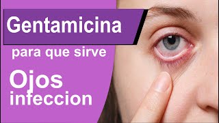 GENTAMICINA para que sirve meningitis conjuntivitis reaccciones y mas [upl. by Marlea]