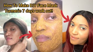 How to Make a DIY Face Mask  TURMERIC MASK for 7 DAYS for Acne and Hyperpigmentation Honest Review [upl. by Annahsal280]