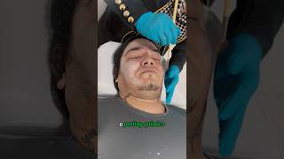 PEELING QUÍMICO ÁCIDO TRICLOROACÉTICO estetica peelingquimico pele shortsvideo [upl. by Anialad956]