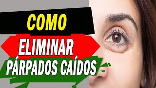 Como eliminar los PÁRPADOS caídos  Belleza [upl. by Hartill]