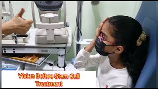 Stem Cell Treatment for Stargardts or Macular Dystrophy [upl. by Akeemaj327]