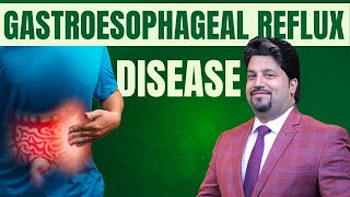 Gastroesophageal reflux disease I Nbp Unani amp Ayurveda Research Centre [upl. by Lahey]