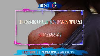 ROSEOLA INFANTUM  DrAREEJ  LECTURE 5 [upl. by Hege]