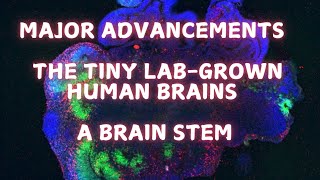 Giving the labgrown brains a brainstem [upl. by Beltran]