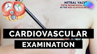 Cardiovascular Examination  OSCE Guide  UKMLA  CPSA [upl. by Woodall]