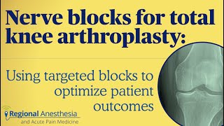 Nerve Blocks for Total Knee Arthroplasty Using Targeted Blocks to Optimize Patient Outcomes [upl. by Schroder]