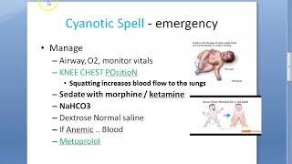 Pediatrics Cyanotic Spell TOT Blue baby Propranolol VSD Emergency Heart Knee Chest Metoprolol [upl. by Immas]