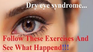 ⏹Eye exercises for  dry eyes [upl. by Elleinwad184]