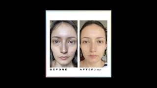 Real Face Yoga Results  Before And After beautytips shorts [upl. by Ymmac]