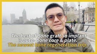 The best of Bone graft in implant is auto bone core amp plate The newest bone regeneration trip [upl. by Ilram868]