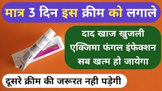 मात्र 1 क्रीम से दाद खाज खुजली 3 दिन में खत्म Best Ketoconazole Cream For Fungal Infection Problems [upl. by Goulden]