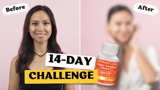 Watch the dAlpha Tocopherol Myra E 14Day Challenge [upl. by Nelly842]