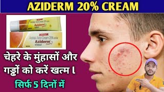 Aziderm 20 cream use dose benefits and side effects full review in hindi [upl. by Aay495]