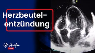 Brustschmerz ohne Herzinfarkt  Die Perikarditis Teil 2  DrHeart [upl. by Nester]