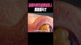 發明內視鏡縮胃術的人真是個天才科普 知識有趣 [upl. by Ivanah]