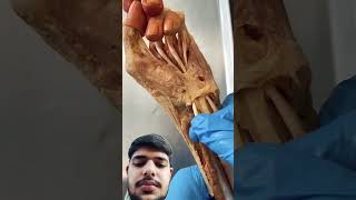 Tugging on a Real Human Thumb Tendon [upl. by Chesnut]